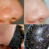 CarbonClear Blackhead Removal Mask