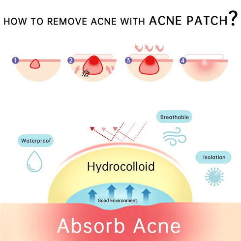 (BUY 1 GET 2) AUQUEST - Invisible Zit Patch