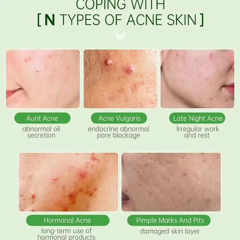 TEA TREE - Serum Acne Removal