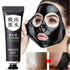CarbonClear Blackhead Removal Mask