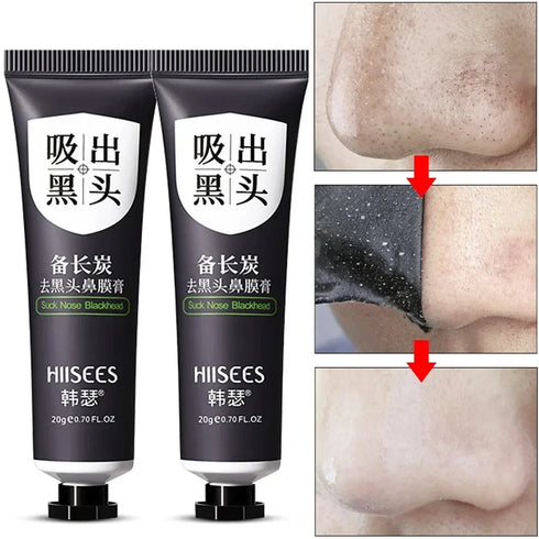CarbonClear Blackhead Removal Mask
